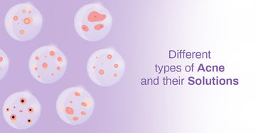 Different Types of Acne and Their Solutions