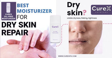 Best Moisturizer for Dry Skin in Pakistan - Hydrating & Oil-Free
