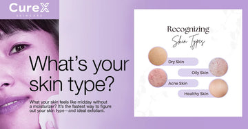 What Are the Main Skin Types? - Identify & Care for Your Skin Type
