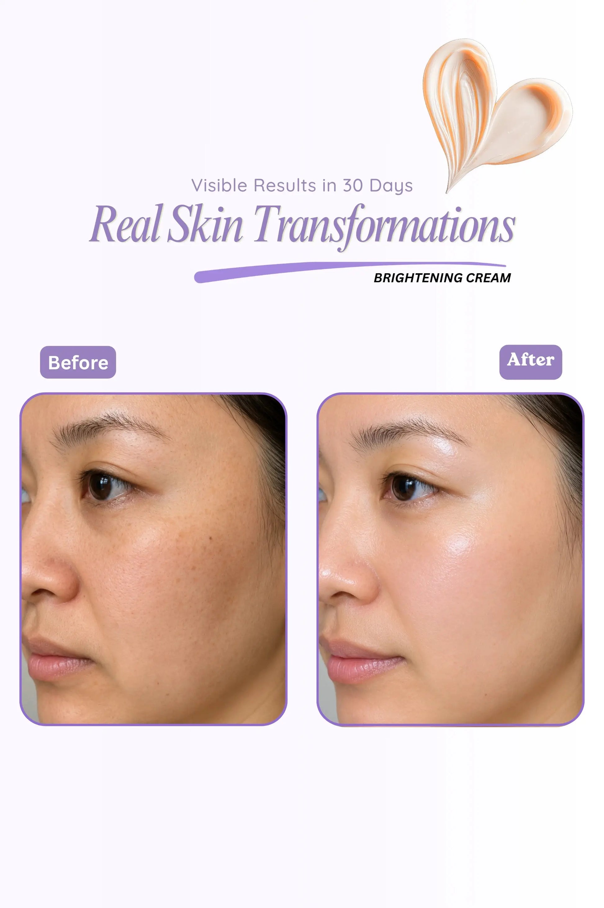 Before and after comparison of a woman's face with brightening cream, showing visible skin transformation.