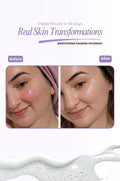 Before and after comparison of a person's skin with visible brightening effects, featuring a brightening foaming facewash advertisement.