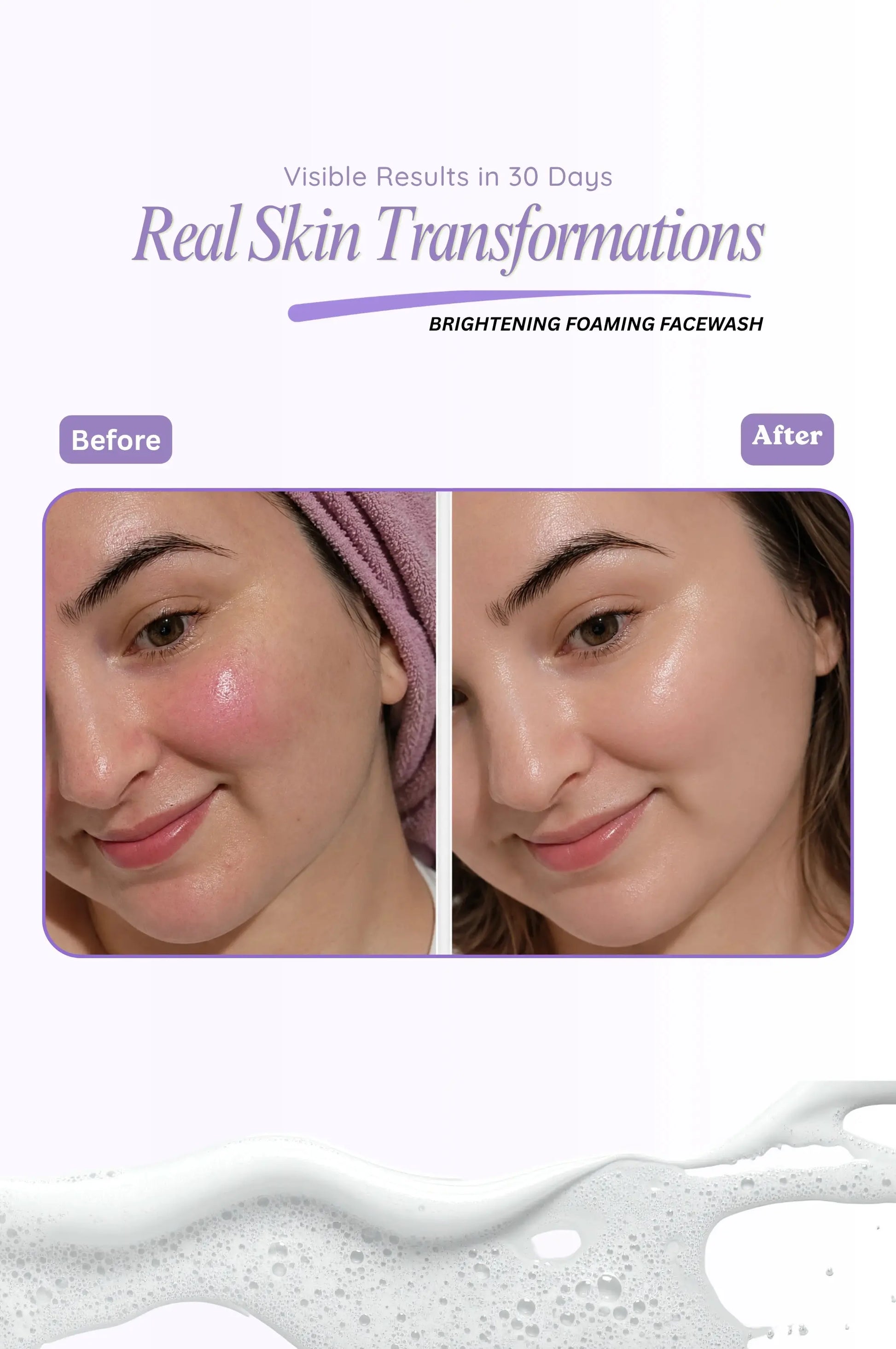 Before and after comparison of a person's skin with visible brightening effects, featuring a brightening foaming facewash advertisement.