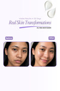 Before and after skin transformation with oil-free moisturizer on a white background