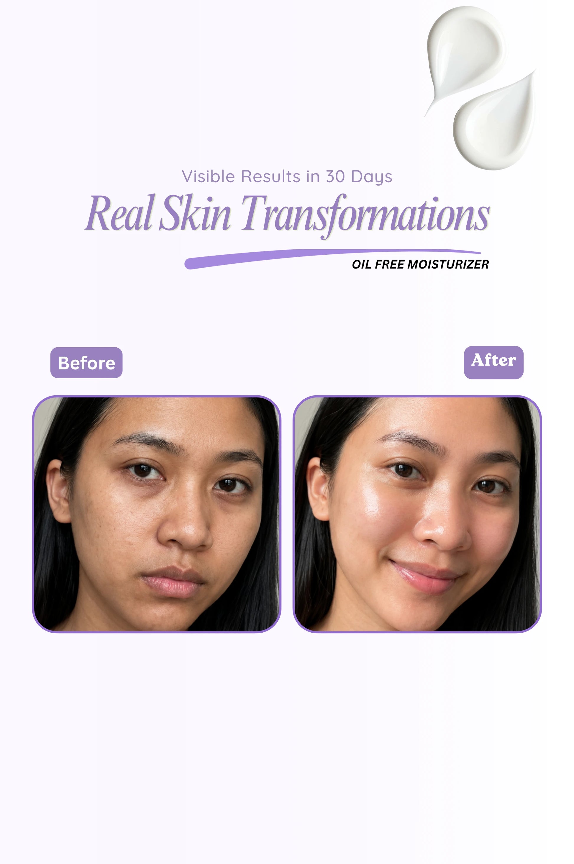 Before and after skin transformation with oil-free moisturizer on a white background
