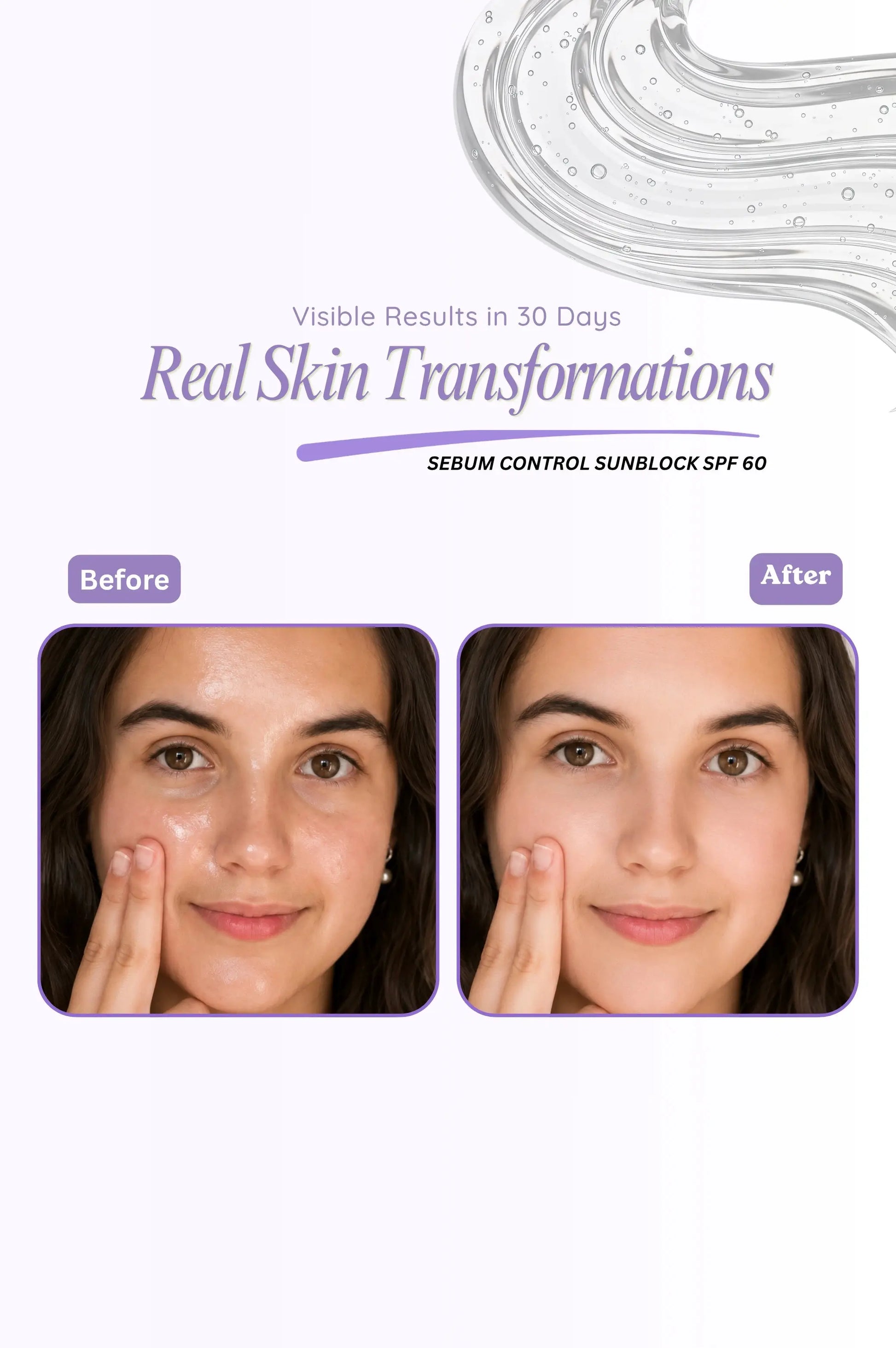 Before and after skin transformation with sunscreen application, showing visible results in 30 days.