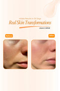 Before and after comparison of skin transformation using a vitamin C serum.