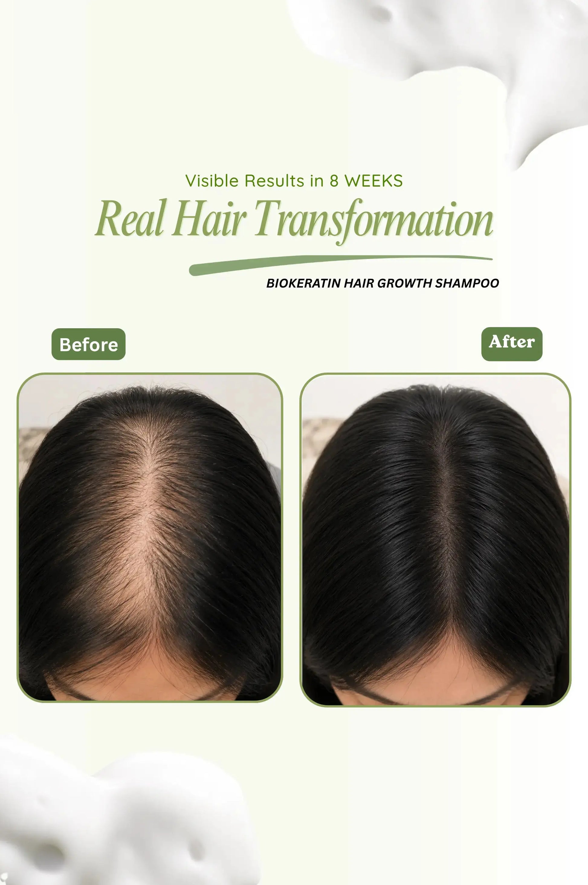 Before and after comparison of hair growth using Biokeratin hair growth shampoo.
